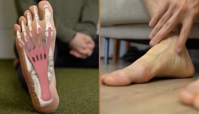 What-Is-Plantar-Fasciitis What Is Plantar Fasciitis