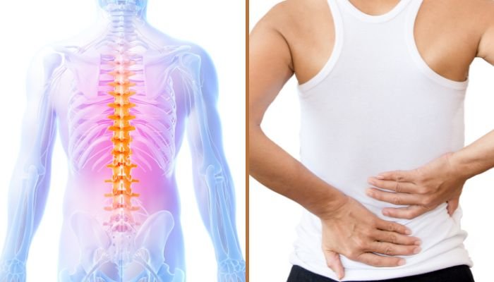 What-Causes-Lower-back-Pain What Causes Lower Back Pain